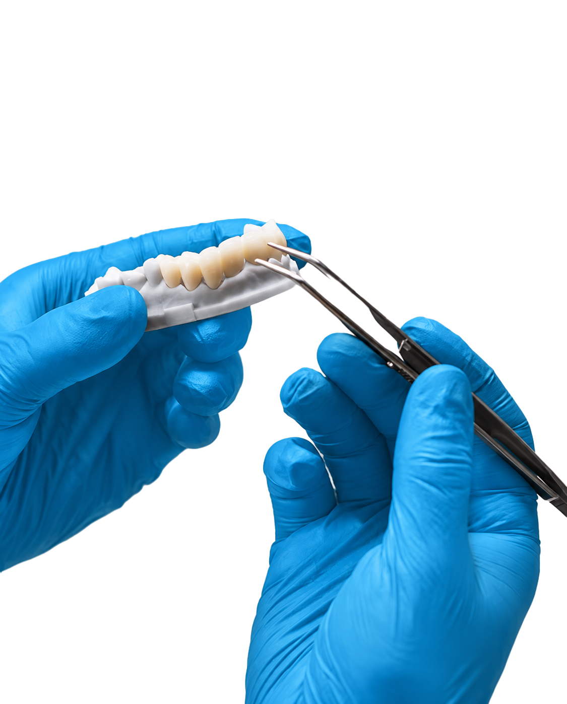 Adjusting a dental bridge